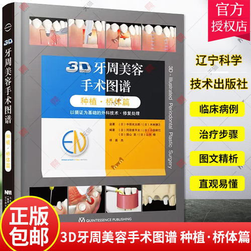 3D牙周美容手术图谱 种植·桥体篇 口腔科书籍 医学参考书籍 2020年1月DIYI版 冈田素平太等编 著 9787559117243 辽宁科学技术出版