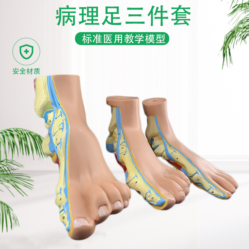 正常关节爪形脚部解剖医院模型