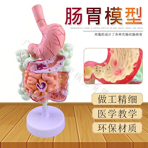 大肠病理模型肠胃模型结肠病变