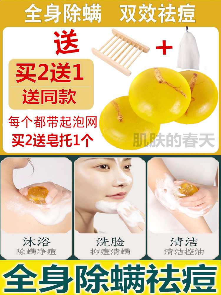 脸上螨虫除螨祛痘皂洗脸专用除虫满香皂青春痘去痘女初中生下巴痘