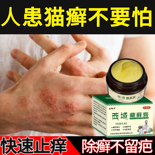 人用猫癣药患皮癣皮肤瘙痒红肿真菌感染猫咪传染猫藓止痒外用膏