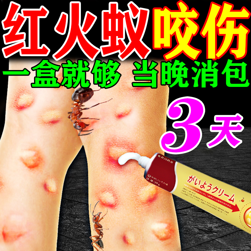 被臭虫跳蚤毒虫红蚂蚁咬伤