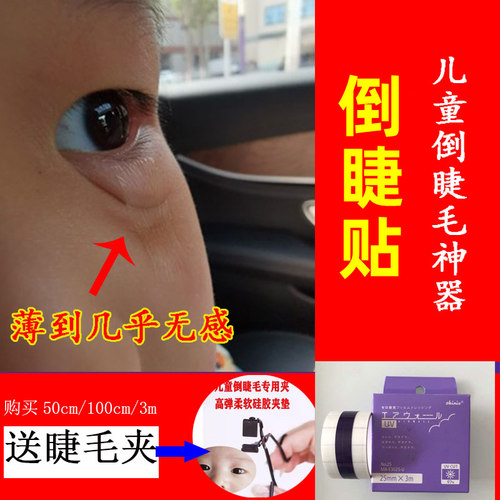 日本倒睫贴儿童倒睫矫正胶带胶布
