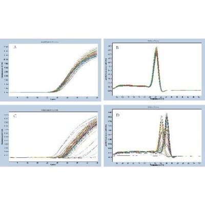 热图韦恩图火山图森林图气泡图单细胞miRNA靶基因转录组RNAseq