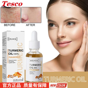 Turmeric Lemon Oil Skin Glow To Lightening Acne Dark Patches