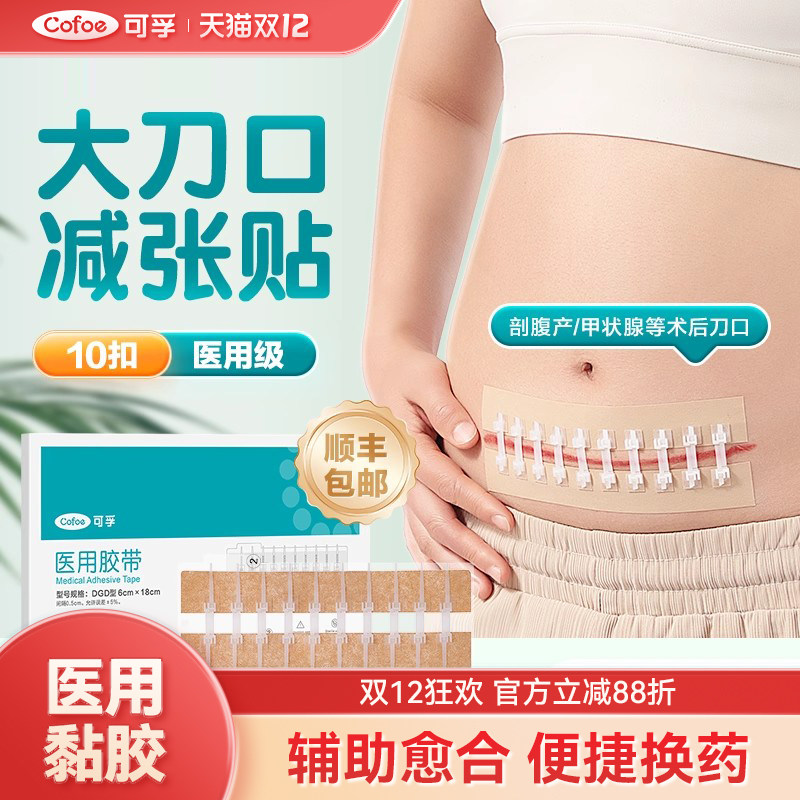 可孚剖腹产减张贴术后伤口愈合贴