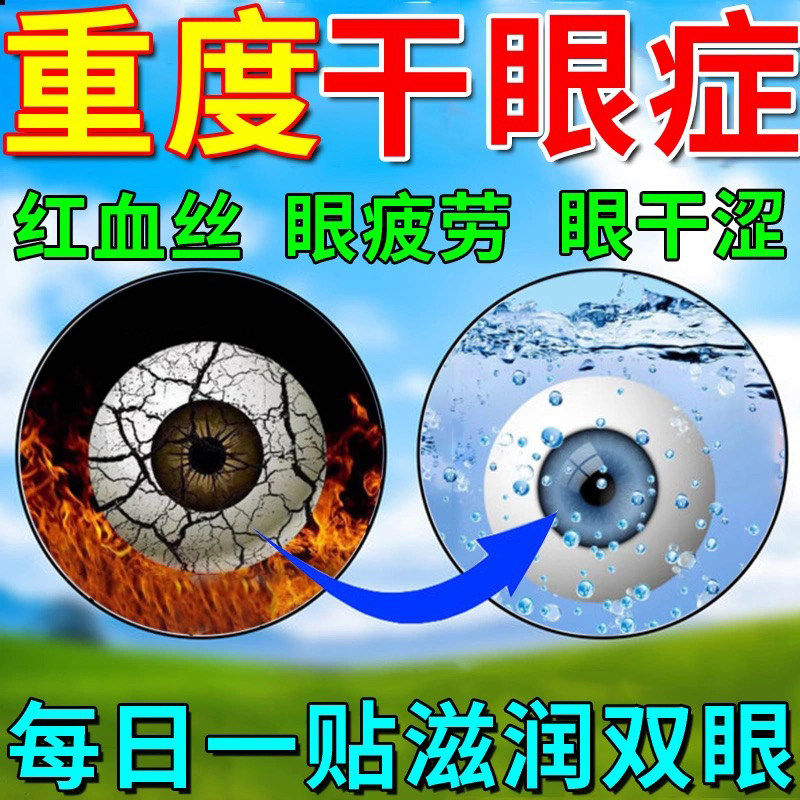 金霉素眼药膏正品眼药水玻璃酸钠滴眼液人工泪液缓解疲劳干涩