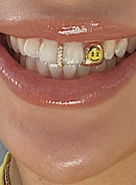 18k金 CPFM笑脸牙饰 / 嘻哈牙套定制 Hiphop Grillz