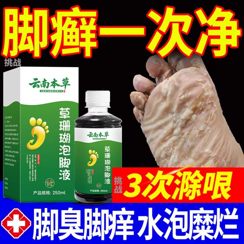 脚藓一次净正品足脚鲜先洗止痒泡保健理疗