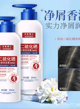 二硫化硒洗发水去屑止痒清爽控油深层清洁柔顺蓬松滋润改善头皮