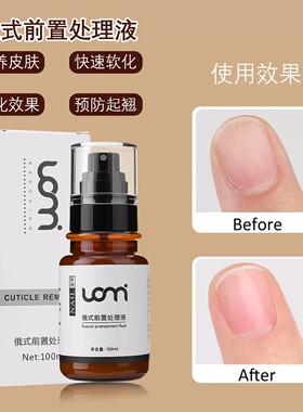 俄式前置处理液美甲店软化死皮角质护理去死皮液态软化剂营养修护