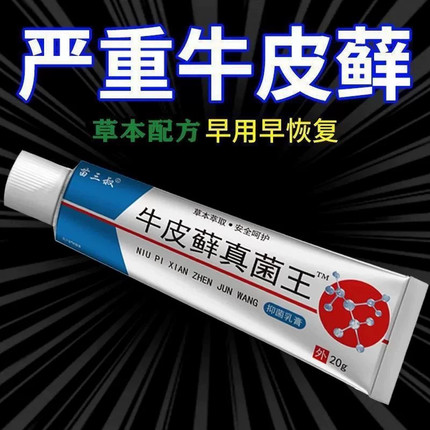 股藓大腿内侧根皮肤瘙痒真菌感染牛皮癣银屑药体股癣去湿疹止痒膏