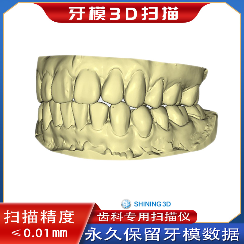 3D牙模扫描电子数据建档