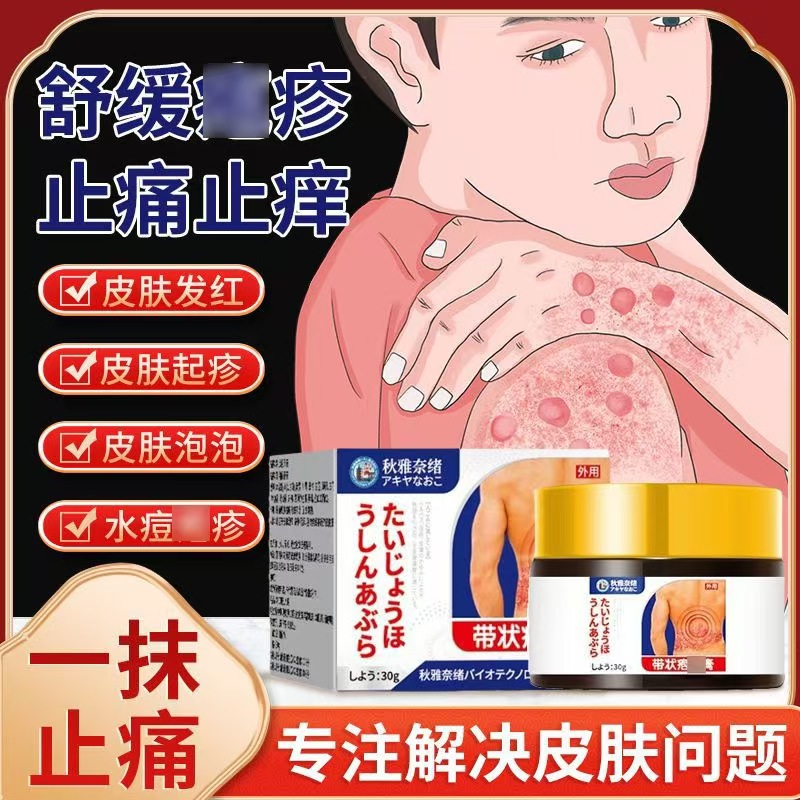 秋雅奈绪带状庖膏后遗神经疼痛灼烧感蛇盘疮腰外用止痒膏进口正品
