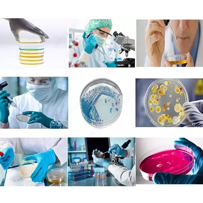 50Pcs Plastic Sterile Petri Dishes Bacteria Culture Dish wi