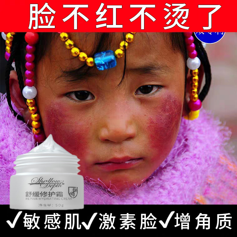 袪除红血丝修复儿童婴儿高原红过敏角质层敏感宝宝肌肤红脸蛋面霜