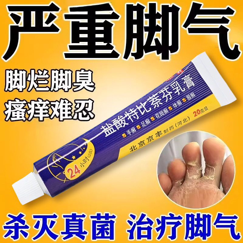 脚气药膏盐酸特比萘芬乳膏正品脱皮杀菌真菌感染烂脚丫药糜烂脚趾