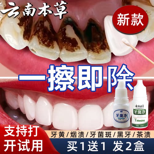 【买一送一】烟渍黄牙黑点牙斑净