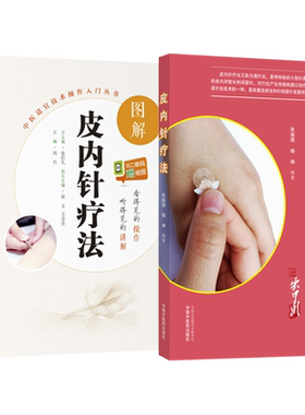 正版3本 图解皮内针疗法+皮内针疗法+皮肤病揿针疗法书 视频 中医针灸治疗学 针灸书籍 针灸学教材 针灸大成 针灸保健 皮内针书籍