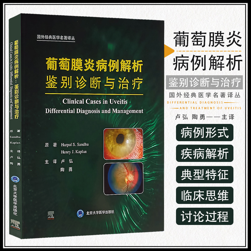 葡萄膜炎病例解析鉴别诊断与治疗