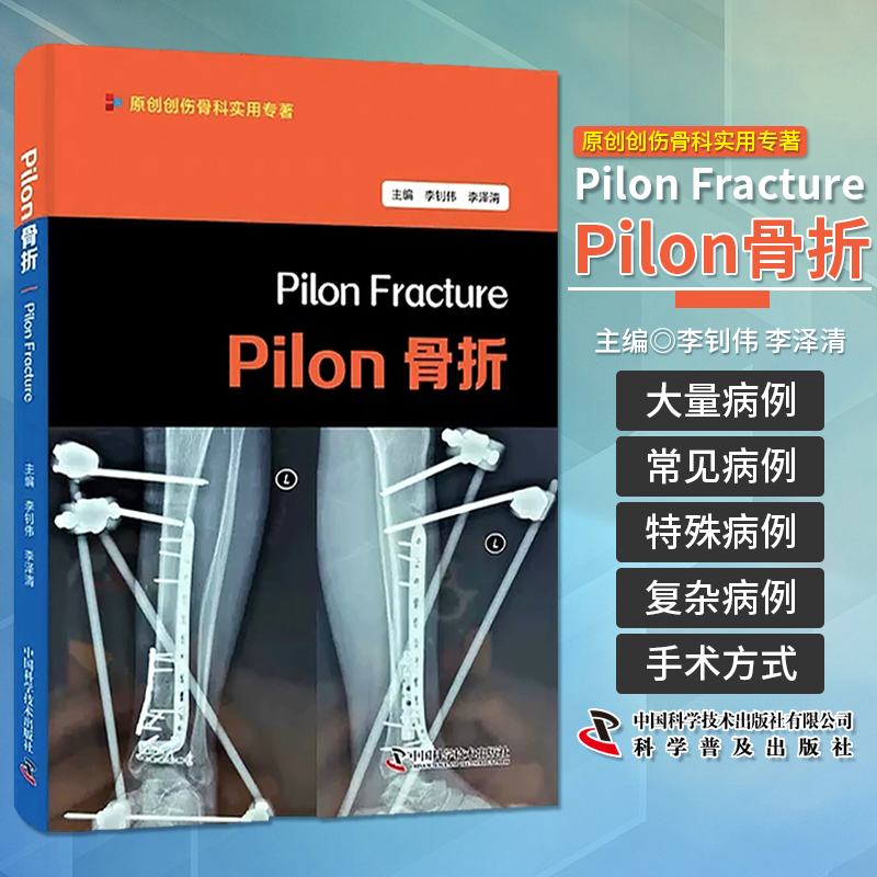 Pilon骨折流行病学解剖特点