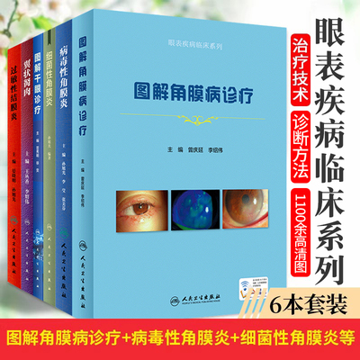 正版全6本 眼表疾病临床系列 图解角膜病诊疗+病毒性角膜炎+细菌性角膜炎+图解干眼诊疗+翼状胬肉+过敏性结膜炎 人民卫生出版社