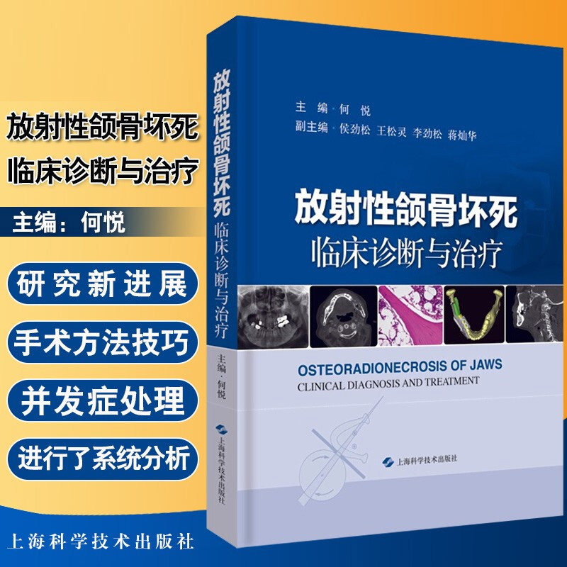 正版 放射性颌骨坏死临床诊断与治疗 何悦 主编 口腔颌面外科肿瘤科等领域医护人员具有指导参考 上海科学技术出版社9787547845943