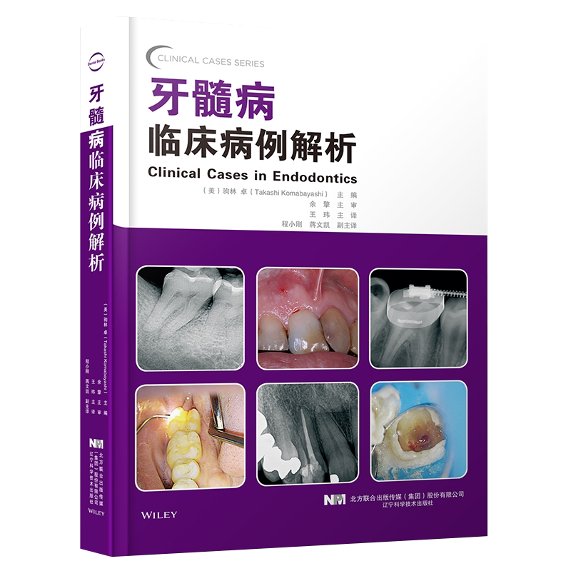 牙髓病临床病例解析 驹林卓编著 生物充填材料牙体牙髓病学牙髓病临床病例释疑牙体牙髓病学指导牙周病牙髓病牙体牙髓病学口腔医学