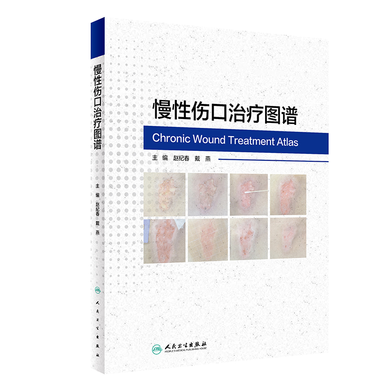 包邮 慢性伤口治疗图谱 伤口损伤现状分析理论 处理方法 注意事项