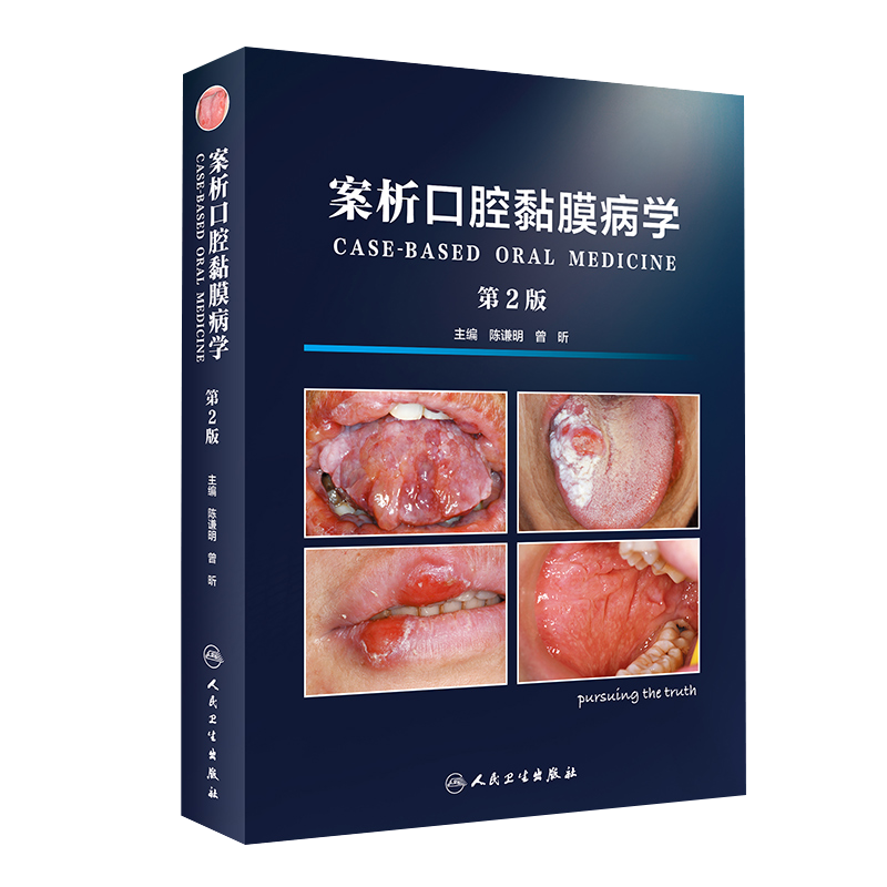 案析口腔黏膜病学第3版上颌窦溃疡感染变态反应性疾病修复保护损害诊断图鉴诊疗指南案例白斑人民卫生出版社牙科牙齿专业口腔书籍
