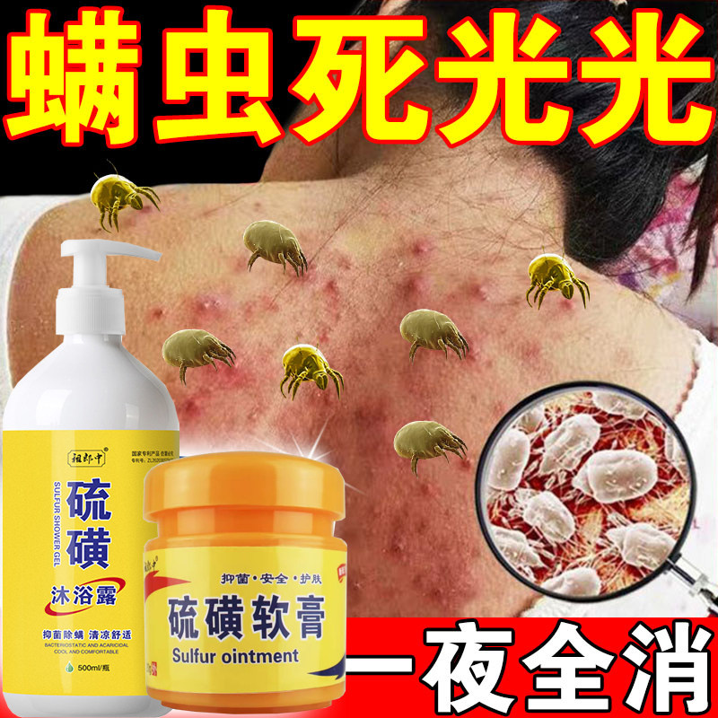 胸前背上长痘痘后背螨虫药膏人用专用除螨叮咬止痒清爽硫磺沐浴露