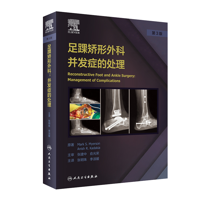 足踝矫形外科并发症的处理 踝关节不稳定与关节融合术 骨科书 高弓足的矫正 张明珠 李淑媛 主译9787117319409人民卫生出版社