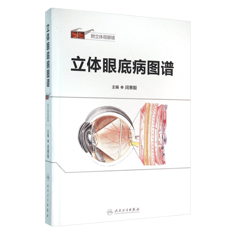 立体眼底病图谱 附立体视眼镜 闵寒毅主编 人民卫生出版社9787117212519