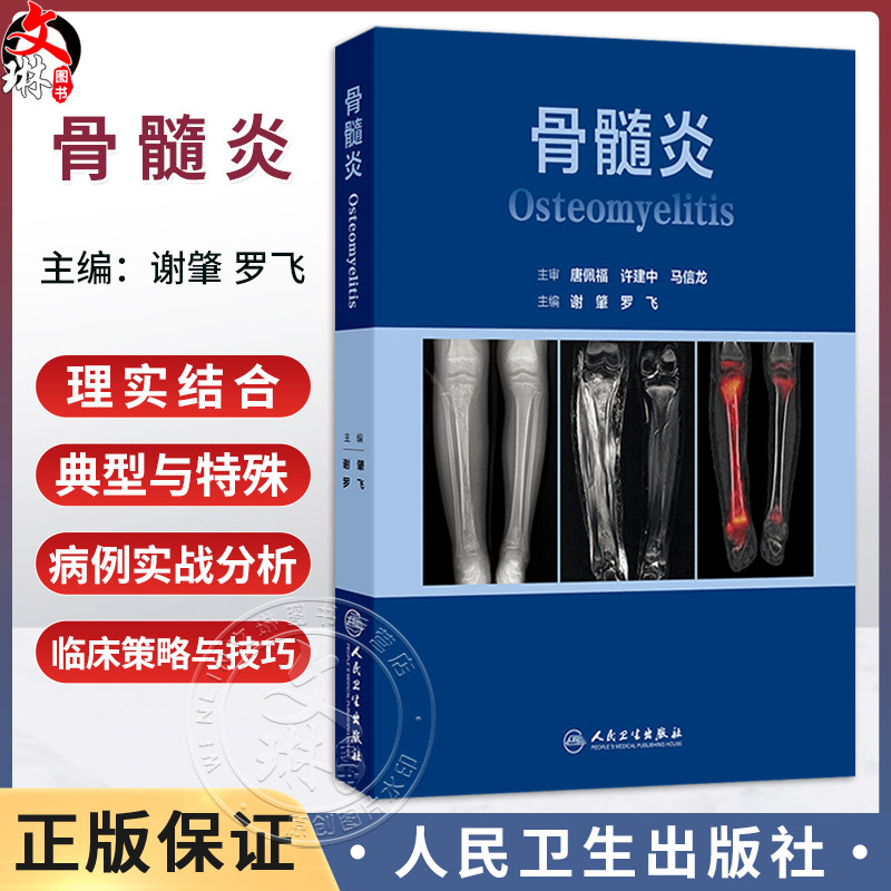 骨髓炎 谢肇 罗飞 主编 本书从基本理论(基础篇) 基本技术(技术篇) 临床应用(各论篇)三大部分依次展开叙述 人民卫生出版社