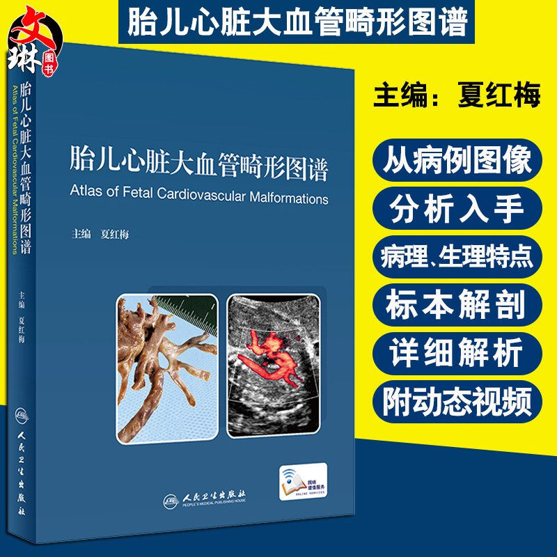 现货速发 胎儿心脏大血管畸形图谱 心血管 胎儿心脏畸形超声诊断 夏红梅 主编 人民卫生出版社 9787117297097