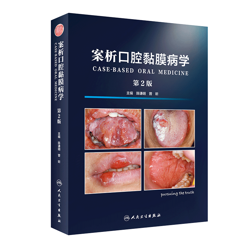 现货 案例口腔黏膜病学 第2版二版 陈谦明 曾昕主编 粘膜病临床案例诊治教程 口腔医学参考工具书籍 人民卫生出版社 9787117287289