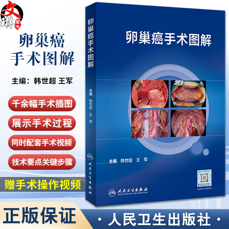 卵巢癌手术图解韩世超王军