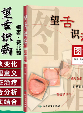 正版现货 望舌识病图谱 第2版二版 费兆馥 顾亦棣编著 人民卫生出版社 图解舌诊 中医舌诊教材书籍 舌像舌苔舌象望舌诊病彩色图解
