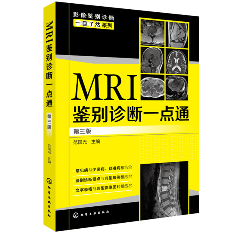 MRI¼ø±ðÕï¶ÏÒ»µãͨ Èý°æ ҽѧӰÏñѧ Ó°Ïñ¿ÆÒ½Ê¦²Î¿¼Êé Ó°ÏñÒ½ÉúºÍÏà¹Ø×¨ÒµµÄ²Î¿¼Êé ÁÙ´²¿ÆÊÒÒ½Éú²Î¿¼Ñ§Ï°Í¼Êé¼®