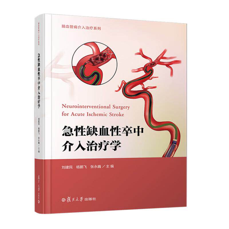 急性缺血性卒中介入学 刘建民 杨鹏飞 张巍 复旦大学出版社9787309176346
