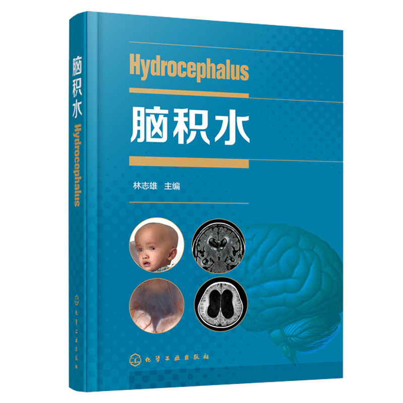脑积水 周良辅 赵继宗 王忠诚 脑血管 脑外科颅脑损伤 神经外科学书神经外科颅底手术入路 显微外科神经内镜 脑手术技术手术技巧书