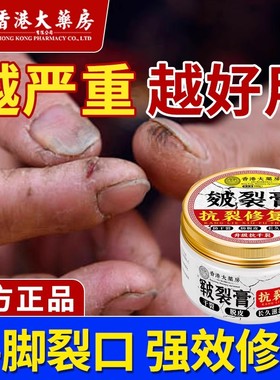 【香港裂王】脚后跟脚趾开裂手足裂口干燥干裂修护霜防脚跟皴裂膏