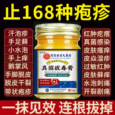汗疱泡疹膏药止痒去手上起小水泡根进口脱皮真菌感染汉状专用软膏