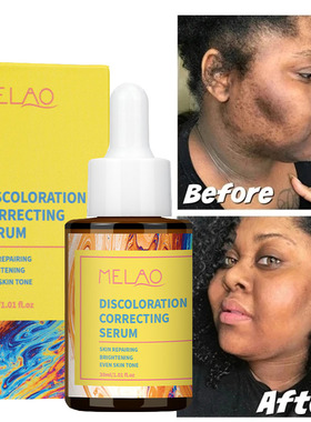 discoloration correcting serum Stubborn Dark Spots色修精华液