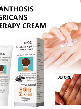 Acanthosis Nigricans Therapy Cream Joint Black黑棘皮修护霜乳