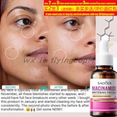 Spots niacinamide Freckle抗皱液 Remove Dark Whitening Serum