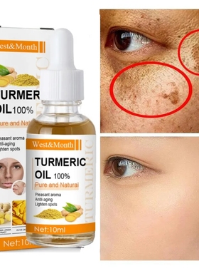 Turmeric Essential Oil Remove Dark Spots Anti Wrinkle Acne油