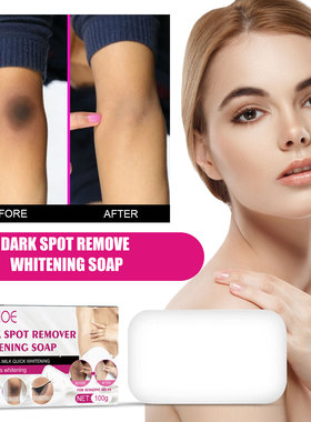 Whitening Soap Dark Skin Bleaching Joint Elbow Dullness香皂