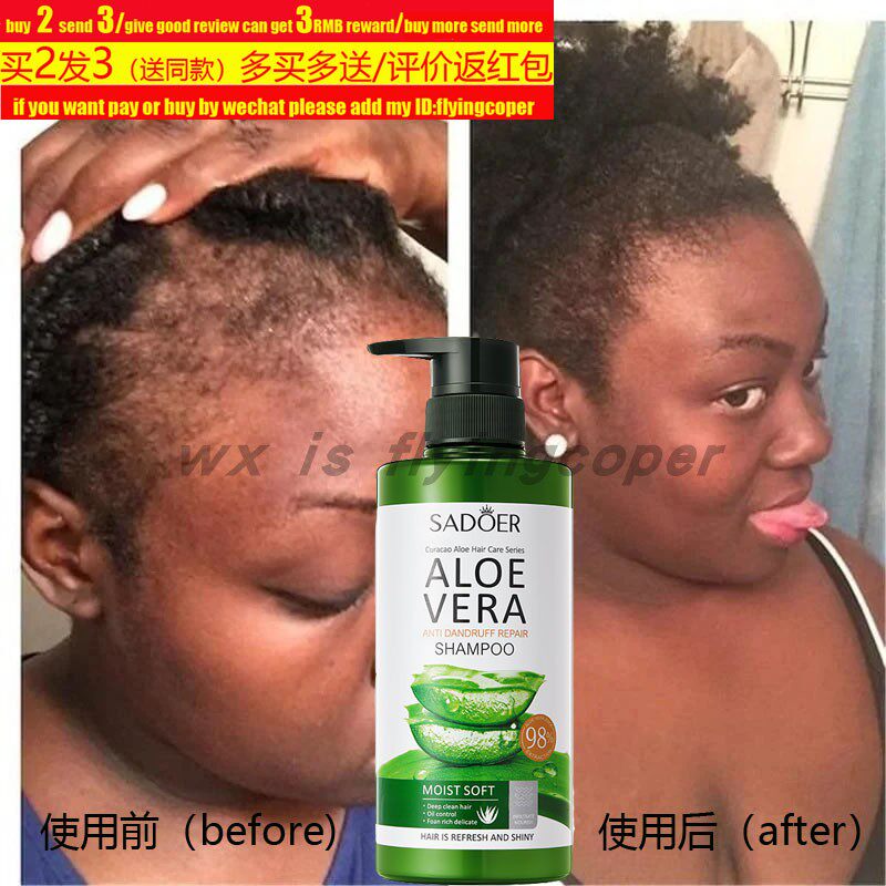 aloeverashampoo洗发水去头屑