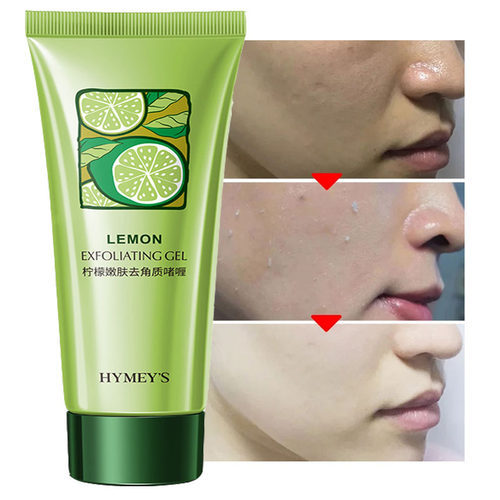 ExfoliatingRemovePeelingGel